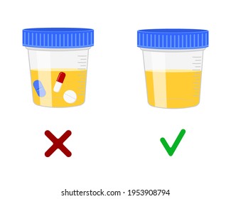 Urinalysis, urine samples with and without drugs. Doping control in sport, post accident drug testing concept. Vector cartoon illustration.