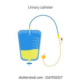 Urinary catheter equipment. Empty bladder and collect urine in a leg bag. Tube from urethra to the internal organ. Urethral drainage hose. Difficulty peeing naturally flat vector illustration