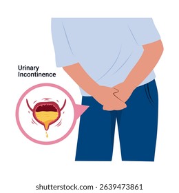 Urinary Incontinence. Overactive bladder illustration. Bladder disease