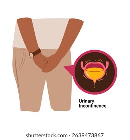 Urinary Incontinence. Overactive bladder illustration. Bladder disease