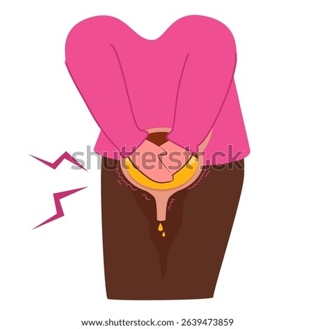 Urinary Incontinence. Overactive bladder illustration. Bladder disease