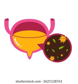 Infección urinaria. Ilustración de enfermedad de la vejiga 