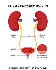 Infección urinaria Síntomas de infección urinaria