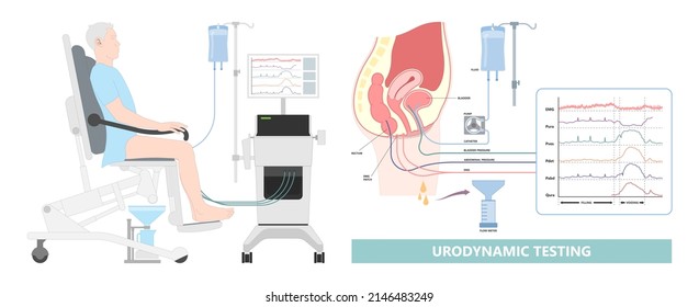 Urination Study Test Urine Leak EMG Urethral Flow Often Tract Exam Diagnose Diagnostic Therapy Bio Feedback Kidney Pelvic Muscle Floor Weak Organ Pain Urge Toilet Enlargement Stress Outlet Cancer