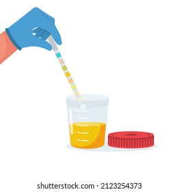 Urine analysis. Doctor in gloves holds an indicator strip in hands.Test icon. Pee sample in plastic box. Medical sample in a glass tube. Laboratory container. Vector illustration flat cartoon design.