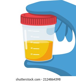 Urine analysis. The doctor in gloves holds jar with urine analysis. Test icon. Pee sample in plastic box. Medical sample in a glass tube. Laboratory container. Vector illustration flat cartoon design.