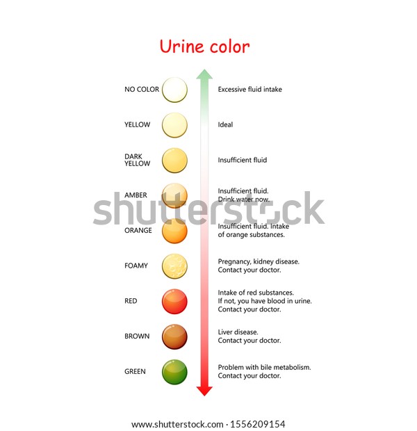 尿の色 水和と脱水を評価するためのグラフ Pee Color図 ベクターイラスト のベクター画像素材 ロイヤリティフリー