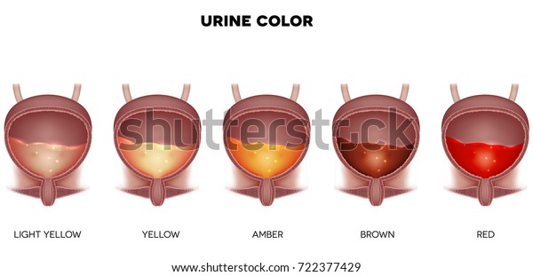 淡黄色から赤色までの尿色表 膀胱3dの内部の詳細な解剖と尿のイラスト のベクター画像素材 ロイヤリティフリー