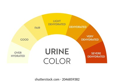 Urine Color Chart. Pee Hydration And Dehydration Test Strip. Vector Design For Medical Education Poster.