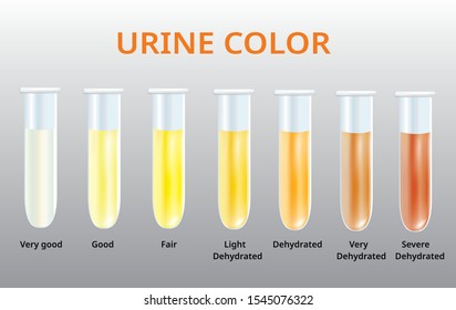 Urine color chart, Urine in Test tubes, medical illustration vector