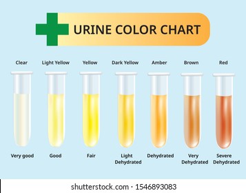Urine color chart, Urine in Test tubes, Medical illustration vector