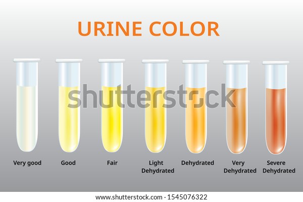 urine color chart medical pinterest colour chart chart and medical ...