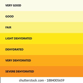 Urine Color Dehydration Urine Color Chart Stock Vector (Royalty Free ...