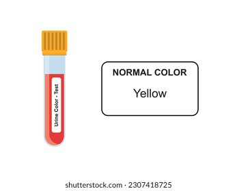 Urine Color Test Concept Design. Vector Illustration.	