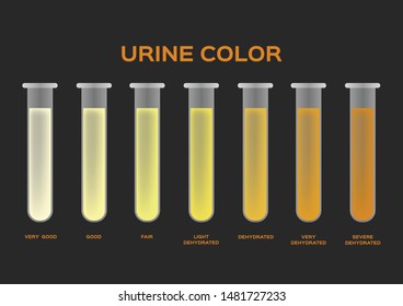 Medical Urine Color Chart