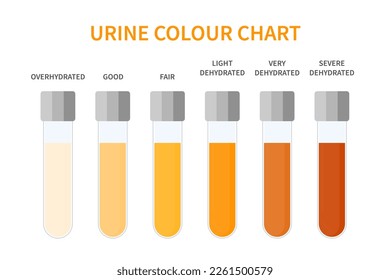 Urine colour chart. Hydration and dehydration level diagram. Medical urinal test kit for urinary tract infection research. Containers with yellow to brown pee for urinalysis. Vector illustration.