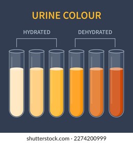 Urine colour chart. Hydration and dehydration level diagram. Medical urinal test kit for urinary tract infection research. Containers with yellow to brown pee for urinalysis. Vector illustration.
