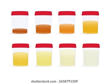 Colores de orina. Muestras de orina en vasos de muestras de diferentes colores. Esto indica el nivel de deshidratación. Ilustración vectorial. Ilustración de stock.