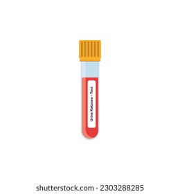 Urine Ketones Test Concept Design. Vector Illustration.	