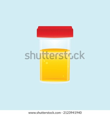 Urine sample specimen in a container for medical diagnosis and laboratorial examination
