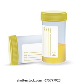 Urine Test In A Plastic Jar Isolated On A White Background. Realistic Vector Illustration.