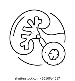 urolithiasis urology line icon vector. urolithiasis urology sign. isolated contour symbol black illustration