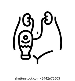 urostomía urología línea icono vector. urostomía urología signo. símbolo de contorno aislado ilustración negra