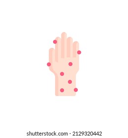 Urticaria Icon, Skin Rash, Hives Color Icon. Medication, Insect Bites Allergy Reaction. Urticaria, Eczema, Psoriasis. Itchy Spots, Irritation On Hand. Chickenpox, Measles Symptom.