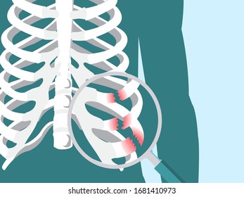 Use a magnifying glass zoom on Broken finger bone illustration vector in x-ray style for Emergency accident injury concept.