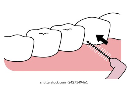 using interdental brush, cleaning teeth - flat illustration