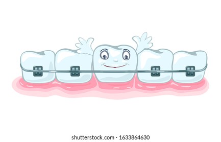 Using of metallic dental braces, orthodontic brackets to correct occlusion, alignment of dentition. Happy healthy beautiful teeth are in gum. Vector cartoon illustration isolated on white background.