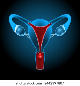 Uterine bleeding. Menstruation. Cut-away view of the uterus. female reproductive system. Vector illustration like X-ray image for healthcare design. Reproductive health.