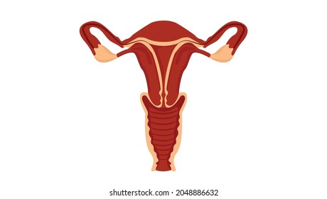Uterine fibroids, Female reproductive system, Medical e-learning vector, Medical education vector