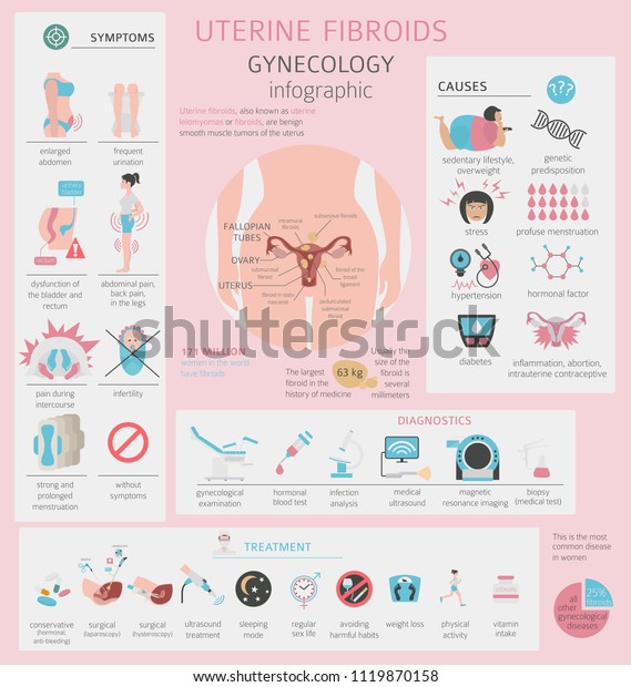 Uterine Fibroids Ginecological Medical Desease Women Stock Vector ...