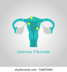 Uterine Fibroids logo vector icon design illustration