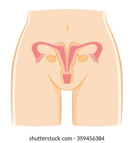 Uterine malformation of illustrations.