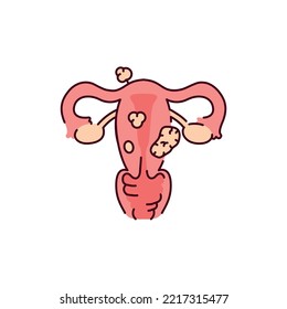 Uterine myoma color line icon. Gynecology problem. Pictogram for web page, mobile app, promo.