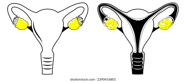 Uterus. icono de la línea negra. Estilo de contorno simple. Pictograma estilizado para diseño web, o aplicación móvil sobre el sistema reproductivo humano. Ilustración vectorial. símbolo de línea plana para uso médico o educativo.
