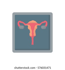 uterus disease x-ray flat icon