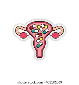 Uterus Organ And Medicine Illustration With Capsules Inside It. Vector Illustration EPS 10