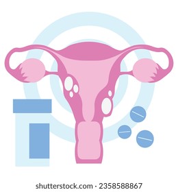 uterus ovaries cervix cancer in flat illustration
