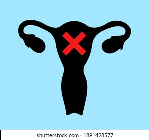 Uterus and womb is crossed out - abortion and termination of pregnancy, miscarriage and death of foetus and fetus, infertile human organ out of order. Vector illustration.