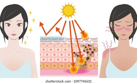 UV care before and after image, young girl puts on the sunscreen or not, mechanism of the sunburn, vector illustration