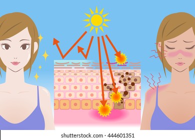 UV care before after image, young girl puts on the sunscreen or not, mechanism of the sunburn, vector illustration