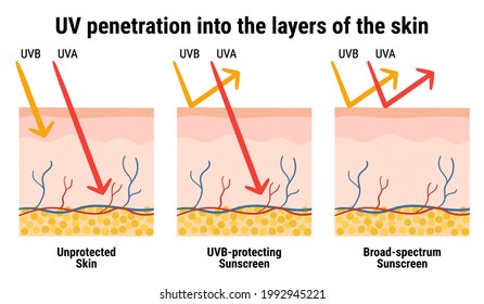 UV penetration into the layers of the skin. Infographic of sunscreen protection against UVA, UVB rays. Skin anatomy. Broad-spectrum sunscreen. Hand drawn organic vector illustration. 