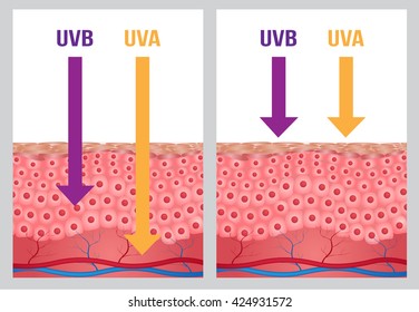 UV protection with cell skin . 2 ultraviolet type comparison 