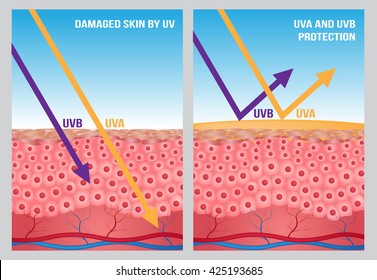 UV protection with cell skin . 2 ultraviolet type comparison with cream lotion