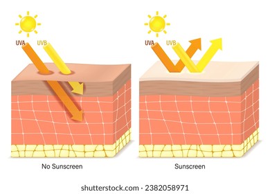 UV Protection. Penetration into the human skin. The difference between skin without sunscreen lotion and skin with sun protection lotion. UVA and UVB radiographs of skin damage.