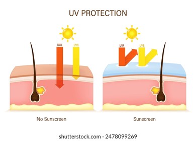 UV Protection. UVA and UVB radiographs of skin damage. Penetration into the human skin. The difference between skin without sunscreen lotion and skin with sun protection lotion. 