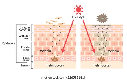 UV radiation induces dark spot by melanin. Human skin layer and cell illustration. Beauty and health care concept 